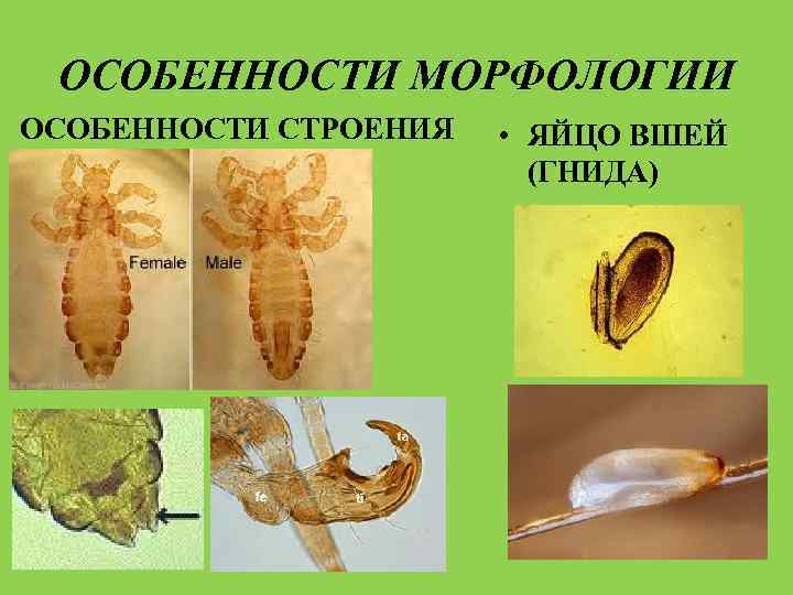 ОСОБЕННОСТИ МОРФОЛОГИИ ОСОБЕННОСТИ СТРОЕНИЯ • ЯЙЦО ВШЕЙ (ГНИДА) 