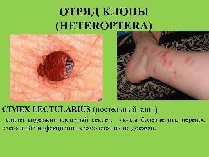 ОТРЯД КЛОПЫ (HETEROPTERA) CIMEX LECTULARIUS (постельный клоп) слюна содержит ядовитый секрет, укусы болезненны, перенос