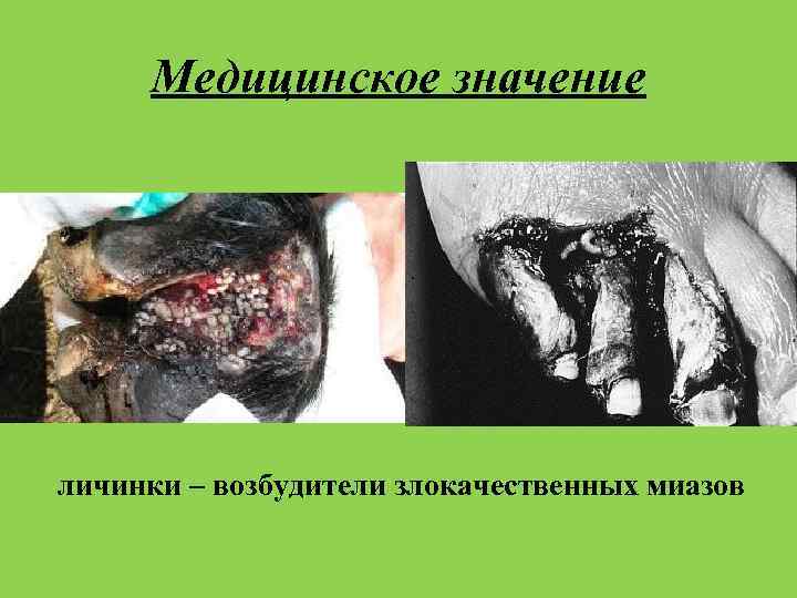 Медицинское значение личинки – возбудители злокачественных миазов 
