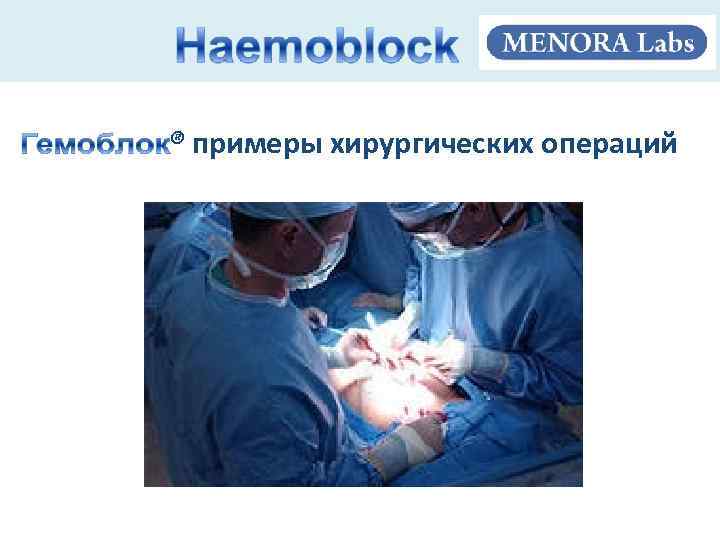 . ® примеры хирургических операций 