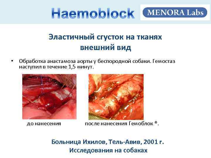 Эластичный сгусток на тканях внешний вид • Обработка анастамоза аорты у беспородной собаки. Гемостаз