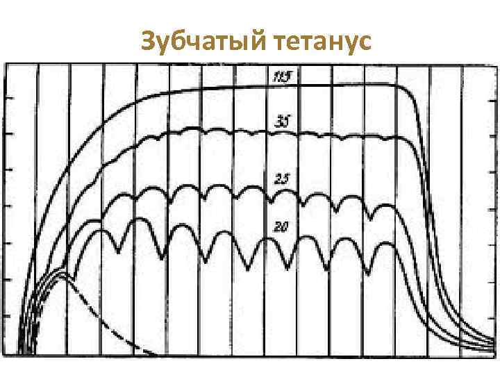 Зубчатый тетанус 