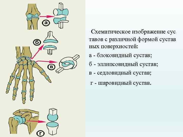  Схематическое изображение сус тавов с различной формой сустав ных поверхностей: а - блоковидный