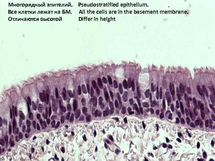 Многорядный эпителий. Pseudostratified epithelium. Все клетки лежат на БМ. All the cells are in