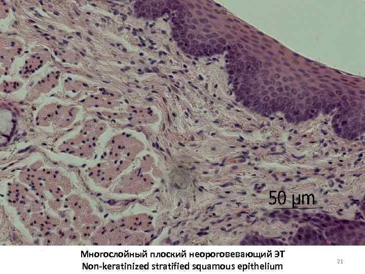 Многослойный плоский неороговевающий ЭT Non-keratinized stratified squamous epithelium 21 