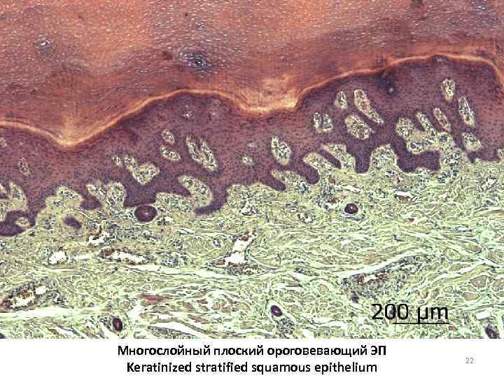 Многослойный плоский ороговевающий ЭП Keratinized stratified squamous epithelium 22 