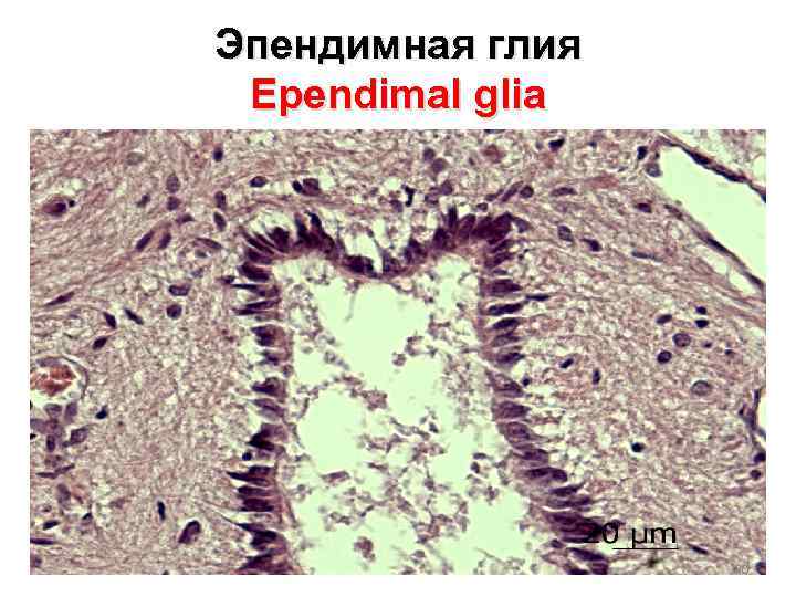 Эпендимная глия Ependimal glia 30 
