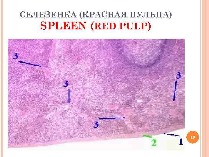 СЕЛЕЗЕНКА (КРАСНАЯ ПУЛЬПА) SPLEEN (RED PULP) 19 