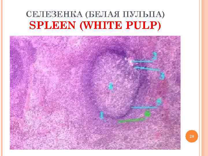 СЕЛЕЗЕНКА (БЕЛАЯ ПУЛЬПА) SPLEEN (WHITE PULP) 20 