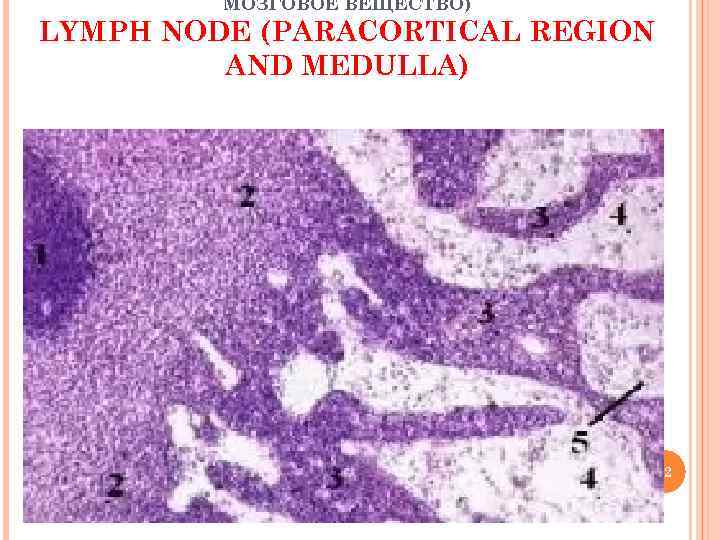 МОЗГОВОЕ ВЕЩЕСТВО) LYMPH NODE (PARACORTICAL REGION AND MEDULLA) 22 