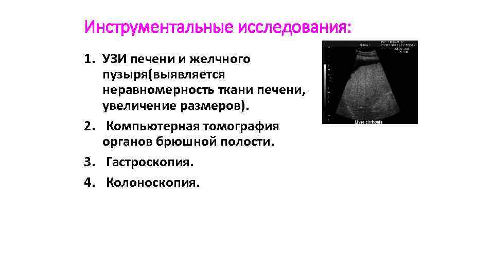 Инструментальные исследования: 1. УЗИ печени и желчного пузыря(выявляется неравномерность ткани печени, увеличение размеров). 2.