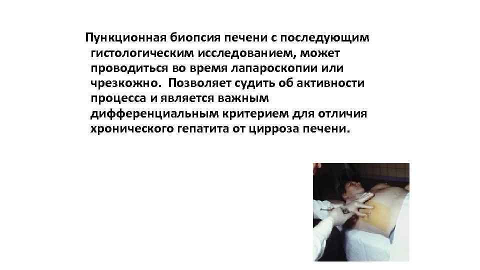 Пункционная биопсия печени с последующим гистологическим исследованием, может проводиться во время лапароскопии или чрезкожно.