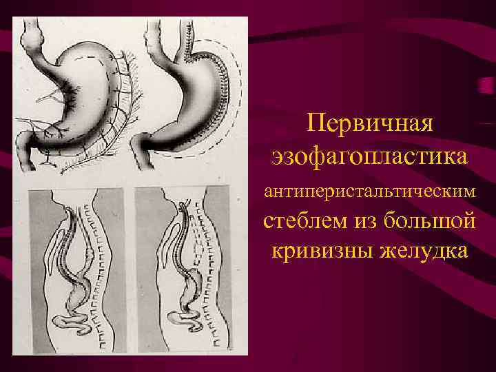 Опухоли общая хирургия презентация