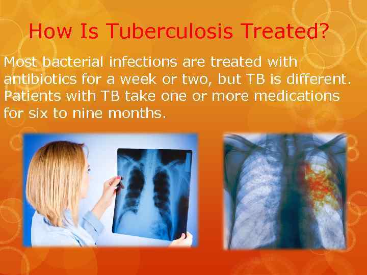 How Is Tuberculosis Treated? Most bacterial infections are treated with antibiotics for a week