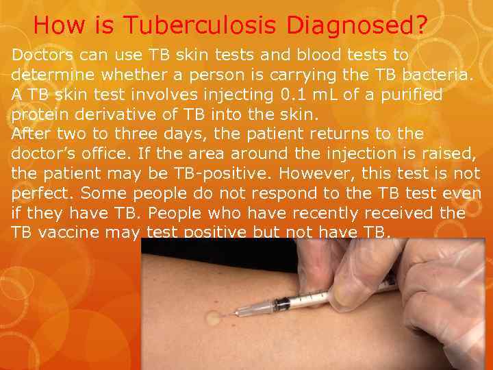 How is Tuberculosis Diagnosed? Doctors can use TB skin tests and blood tests to