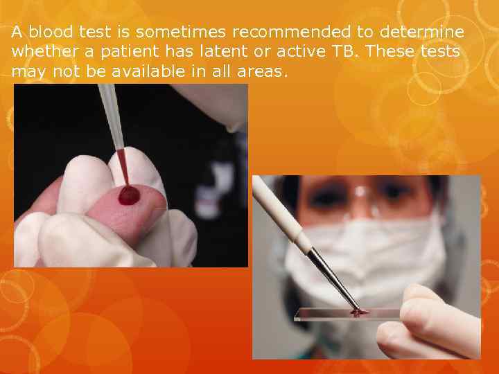 A blood test is sometimes recommended to determine whether a patient has latent or