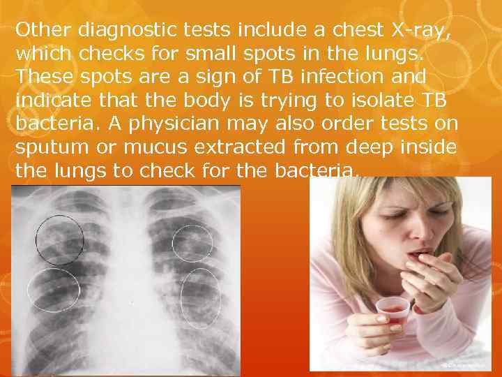 Other diagnostic tests include a chest X-ray, which checks for small spots in the
