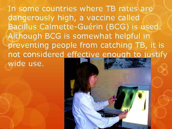 In some countries where TB rates are dangerously high, a vaccine called Bacillus Calmette-Guérin