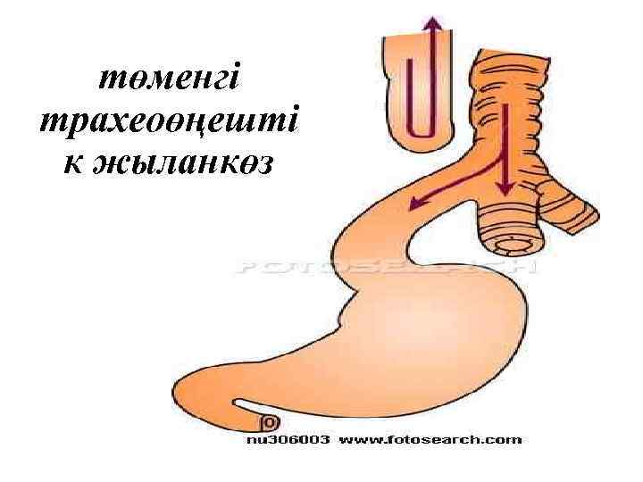 төменгі трахеоөңешті к жыланкөз 
