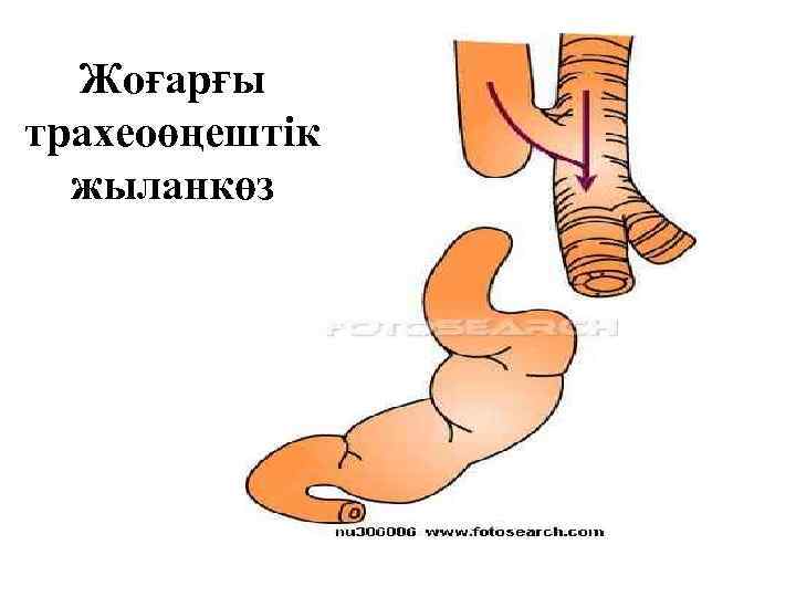 Жоғарғы трахеоөңештік жыланкөз 