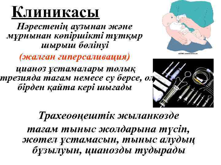Клиникасы Нәрестенің аузынан және мұрнынан көпіршікті тұтқыр шырыш бөлінуі (жалған гиперсаливация) цианоз ұстамалары толық