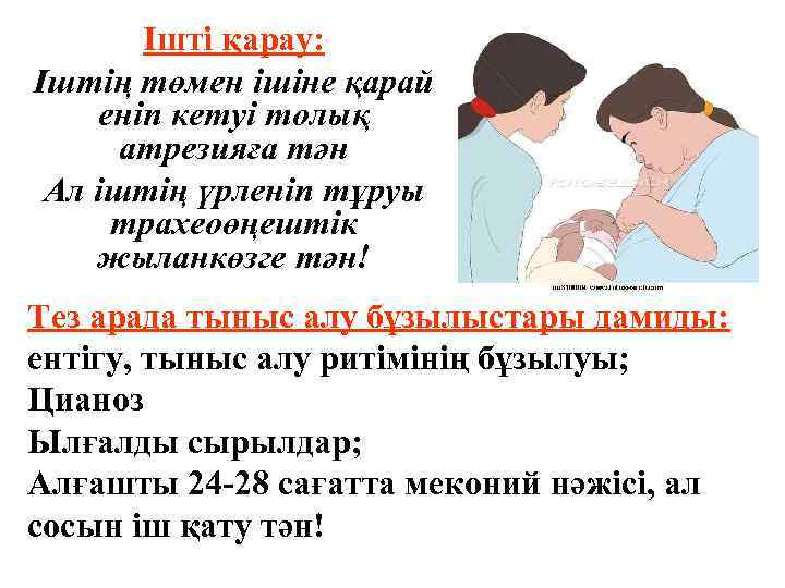 Ішті қарау: Іштің төмен ішіне қарай еніп кетуі толық атрезияға тән Ал іштің үрленіп