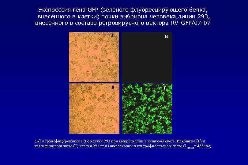 Экспрессия гена GFP (зелёного флуоресцирующего белка, внесённого в клетки) почки эмбриона человека линии 293,