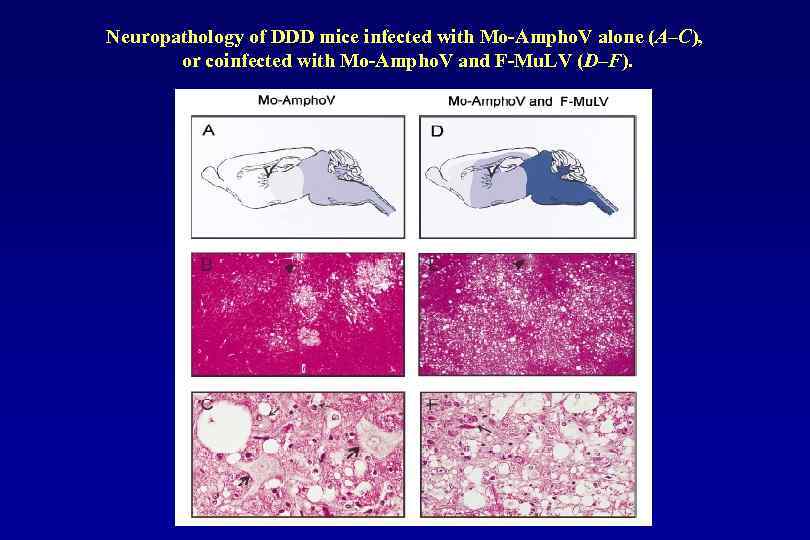 Neuropathology of DDD mice infected with Mo-Ampho. V alone (A–C), or coinfected with Mo-Ampho.