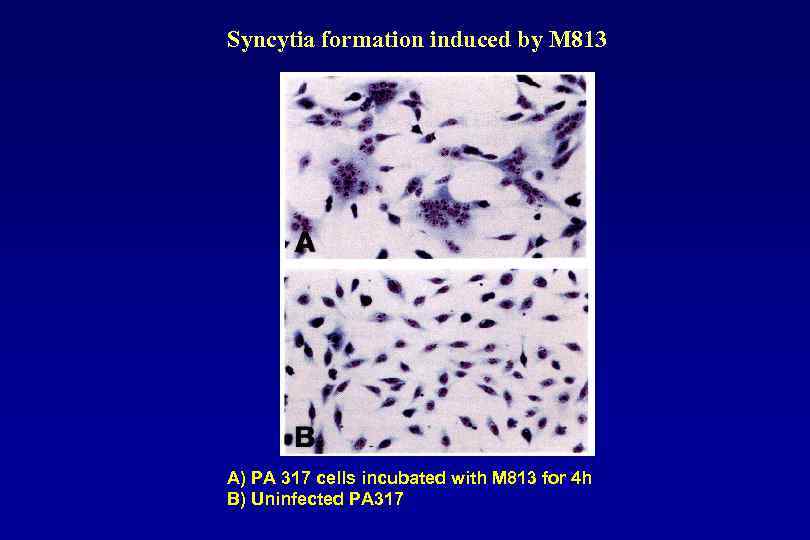 Syncytia formation induced by M 813 А) PA 317 cells incubated with M 813
