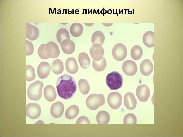 Цитологическая картина неспецифического воспаления