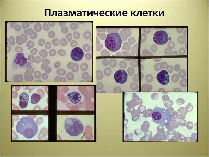 Плазматические клетки в крови фото