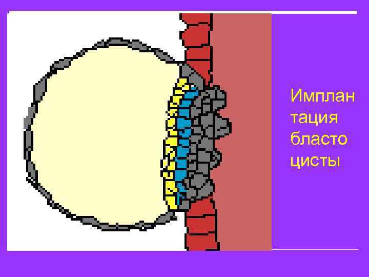 Имплан тация бласто цисты 