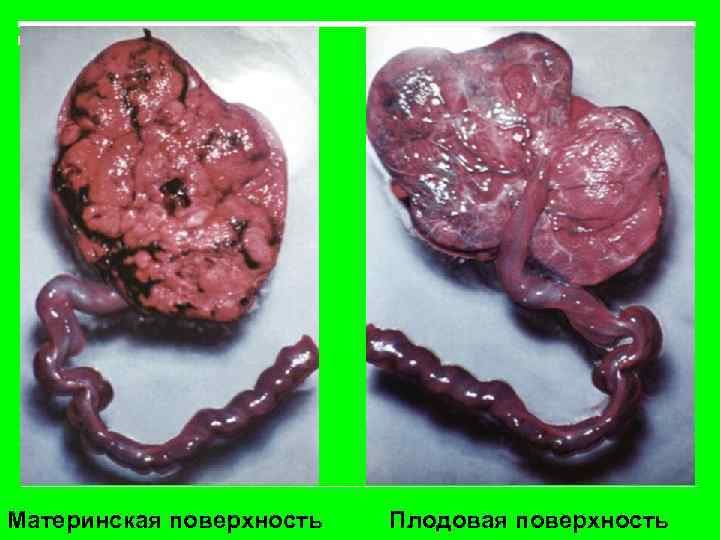 Материнская поверхность Плодовая поверхность 