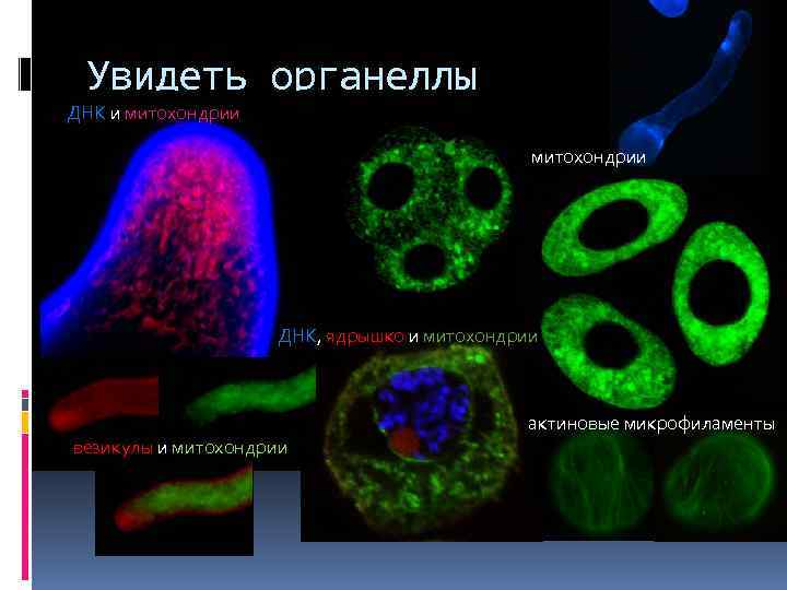 Увидеть органеллы ДНК и митохондрии ДНК, ядрышко и митохондрии актиновые микрофиламенты везикулы и митохондрии