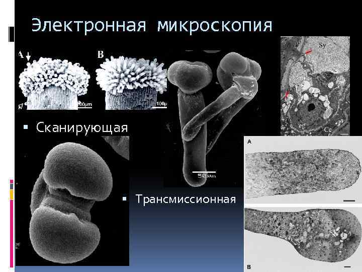 Электронная микроскопия Сканирующая Трансмиссионная 