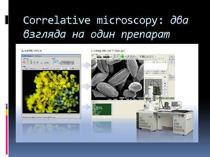 Correlative microscopy: два взгляда на один препарат 