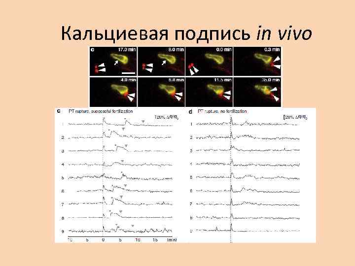 Кальциевая подпись in vivo 