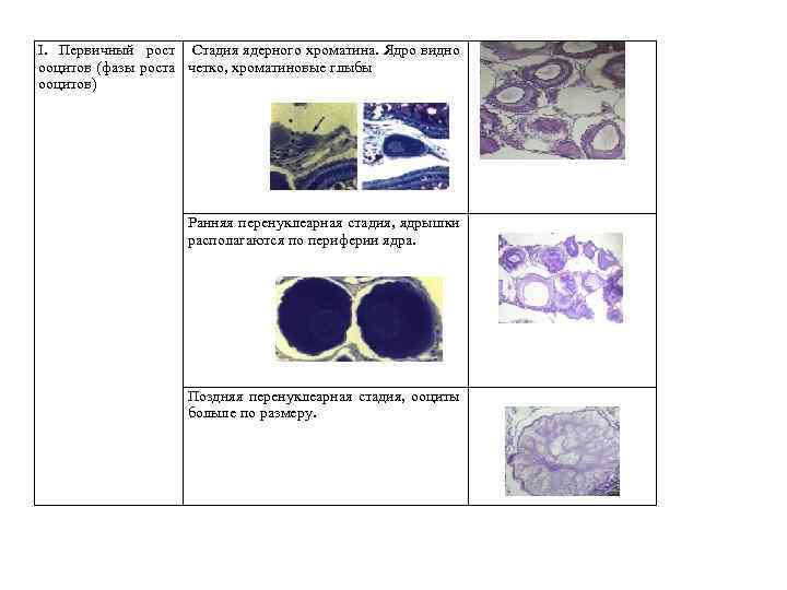I. Первичный рост Стадия ядерного хроматина. Ядро видно ооцитов (фазы роста четко, хроматиновые глыбы
