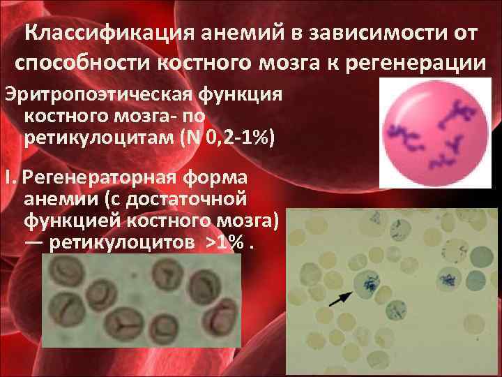 Классификация анемий в зависимости от способности костного мозга к регенерации Эритропоэтическая функция костного мозга-