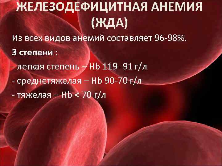 ЖЕЛЕЗОДЕФИЦИТНАЯ АНЕМИЯ (ЖДА) Из всех видов анемий составляет 96 -98%. 3 степени : -
