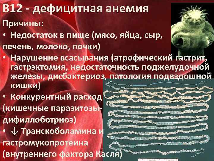 В 12 - дефицитная анемия Причины: • Недостаток в пище (мясо, яйца, сыр, печень,