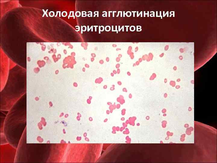 Холодовая агглютинация эритроцитов 
