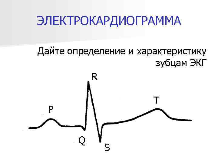 ЭЛЕКТРОКАРДИОГРАММА Дайте определение и характеристику зубцам ЭКГ R T P Q S 