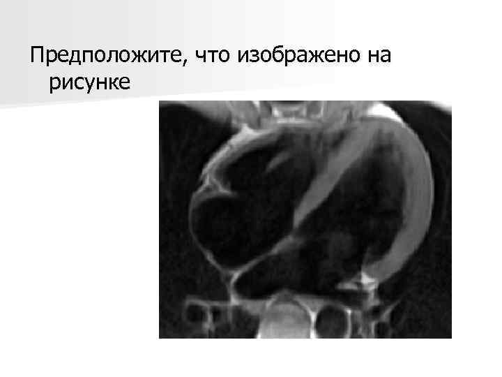 Предположите, что изображено на рисунке 