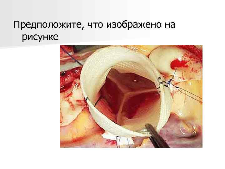 Предположите, что изображено на рисунке 