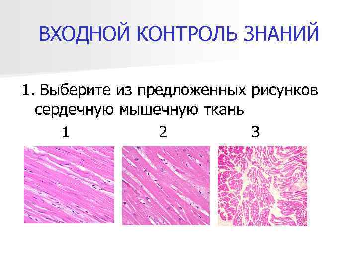 ВХОДНОЙ КОНТРОЛЬ ЗНАНИЙ 1. Выберите из предложенных рисунков сердечную мышечную ткань 1 2 3