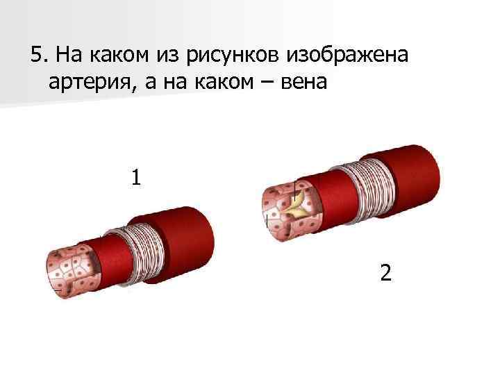 5. На каком из рисунков изображена артерия, а на каком – вена 1 2