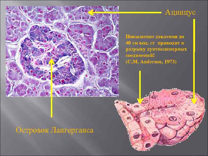 Ацинцус Повышение давления до 40 см вод. ст приводит к разрыву дуктоацинарных соединений! (C.