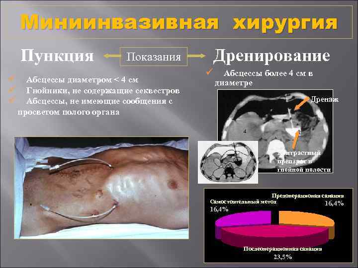 Миниинвазивная хирургия Пункция ü ü ü Дренирование Показания Абсцессы диаметром < 4 см Гнойники,