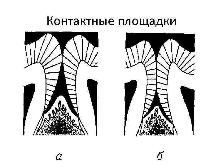 Контактные площадки 